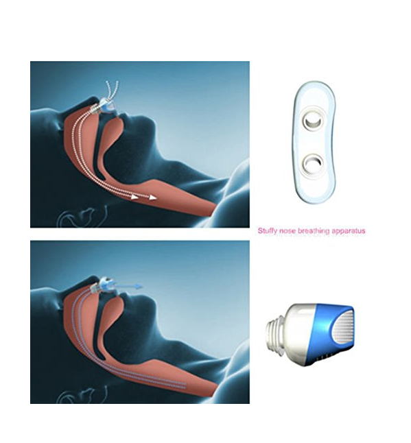 Anti-Snoring & Air Purifier - waseeh.com